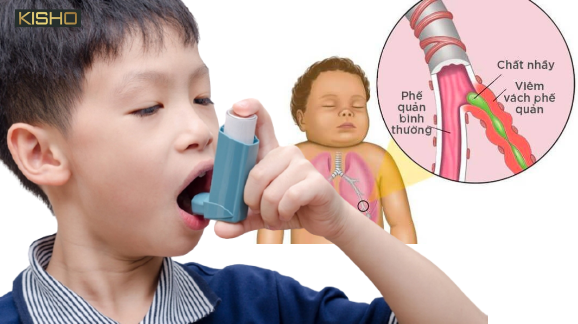tre-bi-hen-phe-quan-co-nguy-hiem-khong