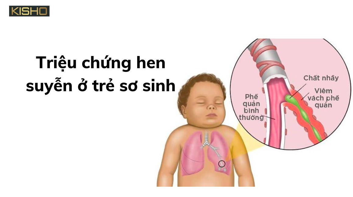 trieu-chung-hen-suyen-o-tre-1